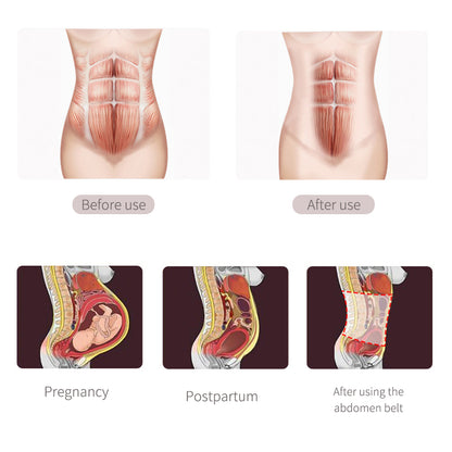 صن فينو - حزام بطن قابل للتنفس لما بعد الولادة - أزرق - مقاس كبير جدًا